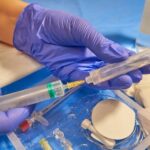 Common Anesthesia Mistakes That Lead to Legal Claims