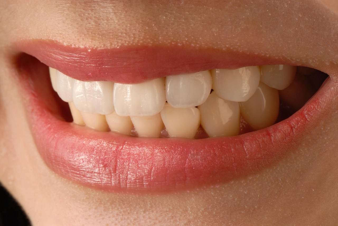 5 Budget-Friendly Paths to Veneers from a Cosmetic Dentist in London