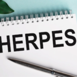 What Arizona Law Says About Herpes Disclosure